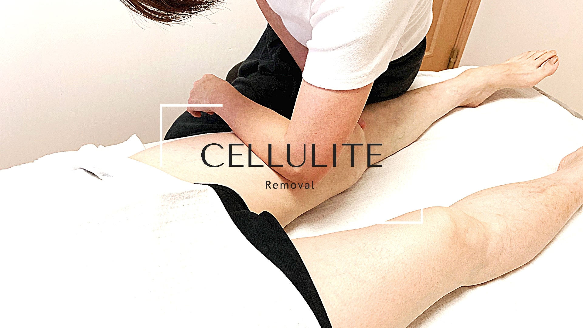 cellulite-legs
